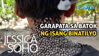 KAPUSO MO JESSICA SOHO  GARAPATA SA BATOK NG BINATILYO [upl. by Aneehsirk]