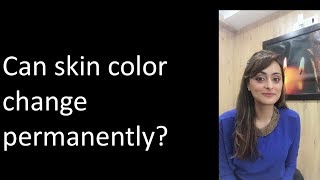 Can your skin tone change from dusky to fair  Dr Aanchal [upl. by Annavoig282]