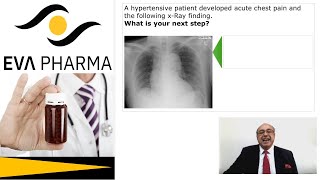 cme internalmedicine Medicine usmle Hypertension  Acute Chest Pain Answer محاضراتباطنة [upl. by Pollerd]