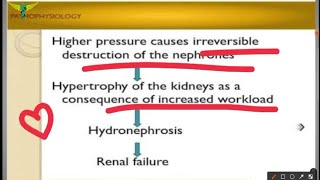 Hydronephrosis [upl. by Ydnil744]