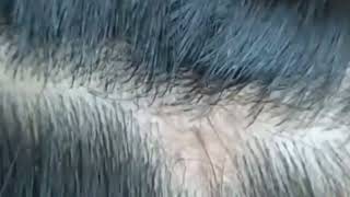 ASMR checking lice and nits and hunting lots of nits👍 part2 [upl. by Anilatsyrc940]