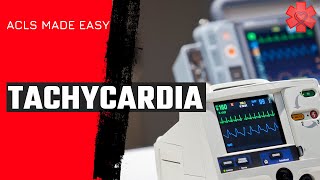 ACLS Tachycardia Algorithm [upl. by Trab]