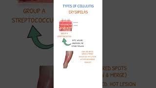 CELLULITIS ERYSIPELAS [upl. by Tepper]