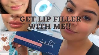 Restylane Kysse Lip Filler Vlog  Sylvia Ruback [upl. by Rihana]