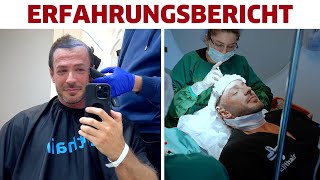 Meine HaartransplantationHaarverdichtung in Istanbul Erfahrungsbericht [upl. by Figge]