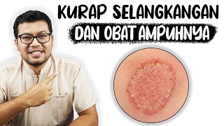 kurap diselangkangan atau Tinea Cruris  DOKTER SADDAM ISMAIL [upl. by Jorrie]