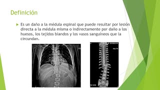 Trauma raquimedular I [upl. by Vasya]