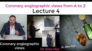 Coronary angiographic views 04 Dr Alaa Nasr [upl. by Evetta600]