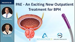 PAE A New Treatment For BPHWebinar [upl. by Morissa534]