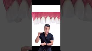 Delhi Dentist Reveals SHOCKING Tooth Loss Effects [upl. by Lirpa]