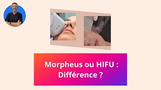 Radiofréquence Morpheus 8 ou Ultrasons HIFU  Lequel choisir  Quelles différences [upl. by Dionne]