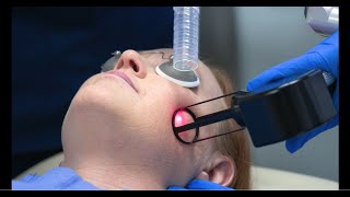 How does fractional CO2 laser resurfacing erase signs of aging [upl. by Anirbas430]