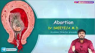 Abortion  Part 1   Obstetrics and Gynaecology Lecture [upl. by Yemrej]