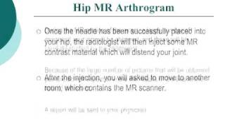 Your Radiologist Explains MR Arthrography of the Hip [upl. by Kina878]