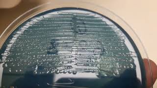 Proteus mirabilis Colony morphology on CLED agar [upl. by Ramma]