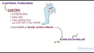 Clostridium Perfringens  Osmosis [upl. by Helena]