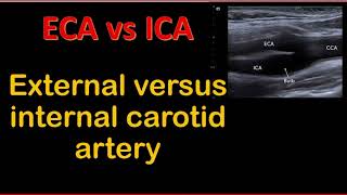 External versus internal carotid artery [upl. by Ellenrahs]