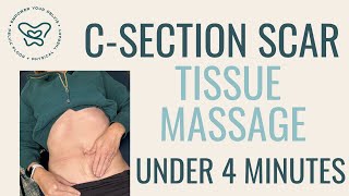 How To Manage Csection Scar Tissue [upl. by Sommer191]