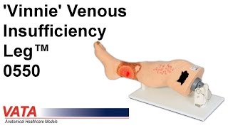 0550  Vinnie Venous Insufficiency Leg™ [upl. by Hoffman]