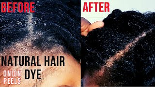 How To Dye Grey Hair At Home With Onion Peels  Get Rid of Gray Hair Naturally Do Not Wash It Out [upl. by Sidnac]