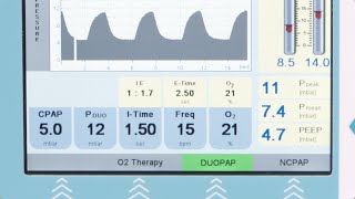 fabian Therapy DuoPAP nasal continuous positive airway pressure on two pressure levels [upl. by Aneris605]