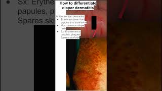 How to differentiate diaper dermatitis [upl. by Erinna]