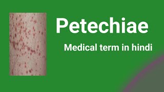 PetechiaeMedical term in hindi [upl. by Tandi]