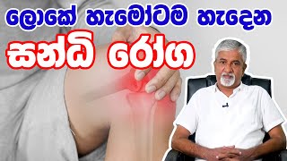 සන්ධි රෝග  Sandi Roga joint disorders ayurvedic treatment  Dr Ashoka Kumara Karunarathna [upl. by Mcintosh871]