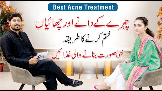 Pimples and Acne Treatment At Home  Skin Care Routine  Dr Huria Arooj  Dr AR Madha [upl. by Eneleuqcaj]