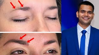 How To Grow Thicker Eyebrows Naturally and Faster  Dr Vivek Joshi [upl. by Rachel565]