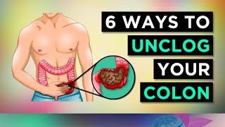 6 Ways To CLEAR Your CONSTIPATION [upl. by Elleunamme]