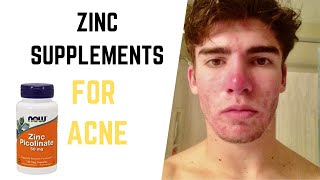 Zinc for Acne  Taking Zinc Supplements for Acne  Natural Acne Treatment [upl. by Ardnic825]