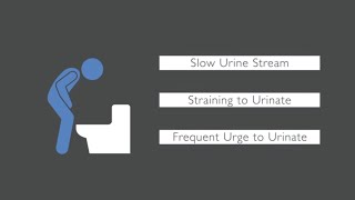 Trouble Urinating What Causes Urinary Issues in Men [upl. by Eelessej]