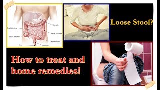 Loose Stool – Causes Treatment Home Remedies [upl. by Elyk574]