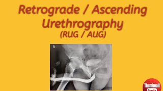 Retrograde  Ascending Urethrography Procedures preparation guide [upl. by Estel]