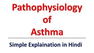 Pathophysiology of Asthma Simple Explaination in Hindi  Bhushan Science [upl. by Ikkin799]