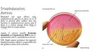 Staphylococcus aureus Microscopic morphology and Cultural Characteristics Part 1 [upl. by Gunar239]