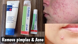 Get rid of Acne amp Pimples INSTANTLY [upl. by Pepper]