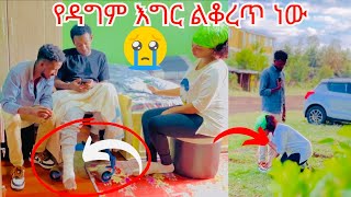 ዳግም እግሩ ልቆረጥ ነው በጣም ከባድ ነገር አጋጣማን 😭😭 My best friend is about to have his leg amputated😭 [upl. by Lallage74]