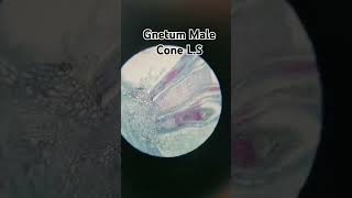 Slide view of gnetum male coneshortvideoscienceshortbotanymicroscopyworldshortvideoshortfeed [upl. by Sinnelg]