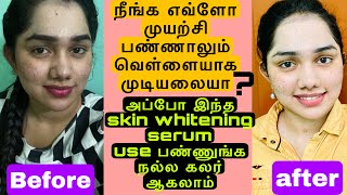 Best skin whitening serum for quick results 💯  Relook skin brightening serum [upl. by Anayad351]