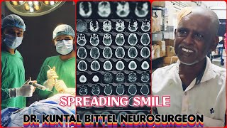 Spreading Smile  Chronic Subdural Hematoma  SDH  Complete Recovery  NEET UG  NEET PG  NEET SS [upl. by Devehcoy58]