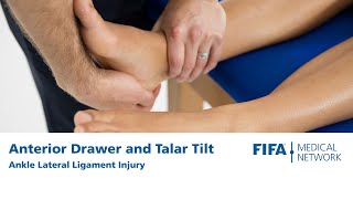 Anterior Drawer and Talar Tilt  Ankle Lateral Ligament Injury [upl. by Bridie541]