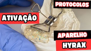 Como deve ser feita a ativação do aparelho Hyrax e o que esse aparelho gera na maxila Aula 165 [upl. by Enicar]