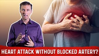 Heart Attack Without Clogged Arteries – DrBerg On Myocardial Infarction amp Heart Problems [upl. by Sergias243]