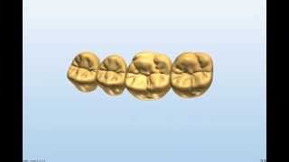 Kastle Mills 3Shape Custom Tooth Library  Exclusively at Kastle Mills in Canada [upl. by Minton]