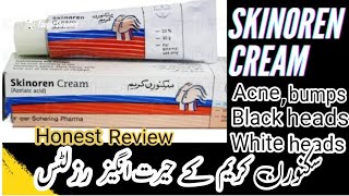 How to use skinoren cream  acne scars treatment  bumps solution  medicated treatment of acne [upl. by Dnyletak43]