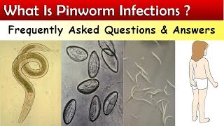 What Is Pinworm Infections   FAQ amp Answers [upl. by Schober]