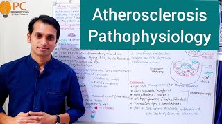 Atherosclerosis Pathophysiology  Etiology and Pathogenesis of Atherosclerosis [upl. by Meece]