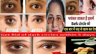 eyes dark circle remove tips  under eye dark circles Dark circles treatment Dr Muzammil Ehsan [upl. by Annaerda815]